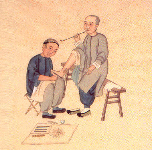 Lithographie chinoise du XIX° siècle représentant un massage du pied